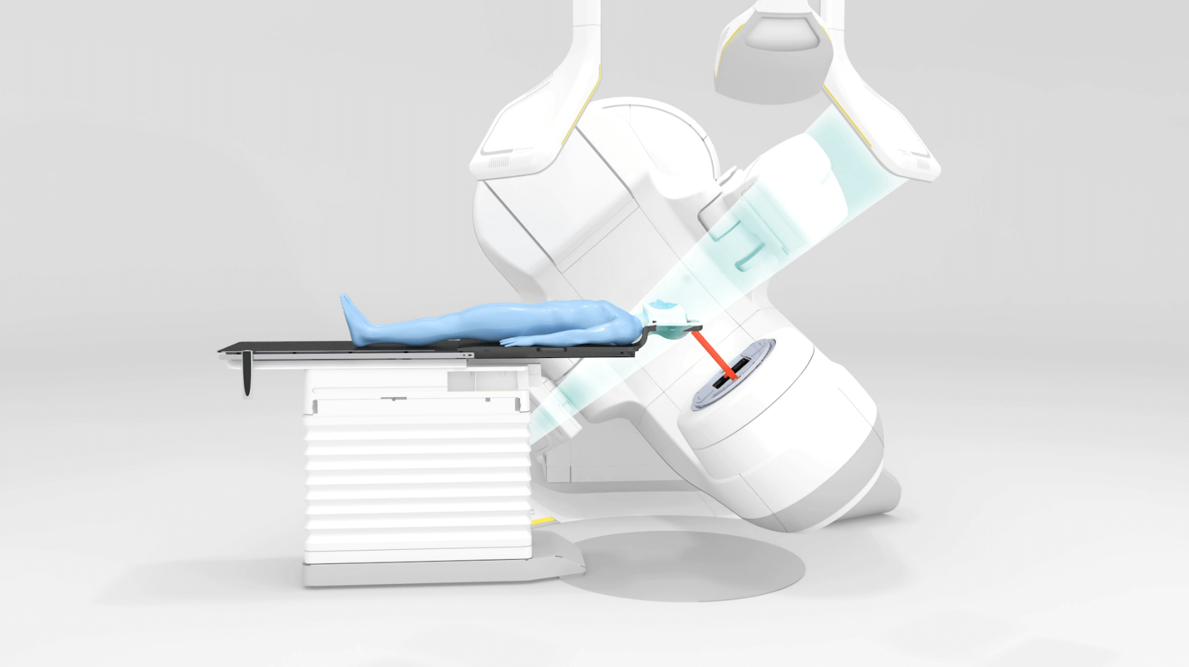 Cranial and Spine SRS & SBRT with ExacTrac Dynamic